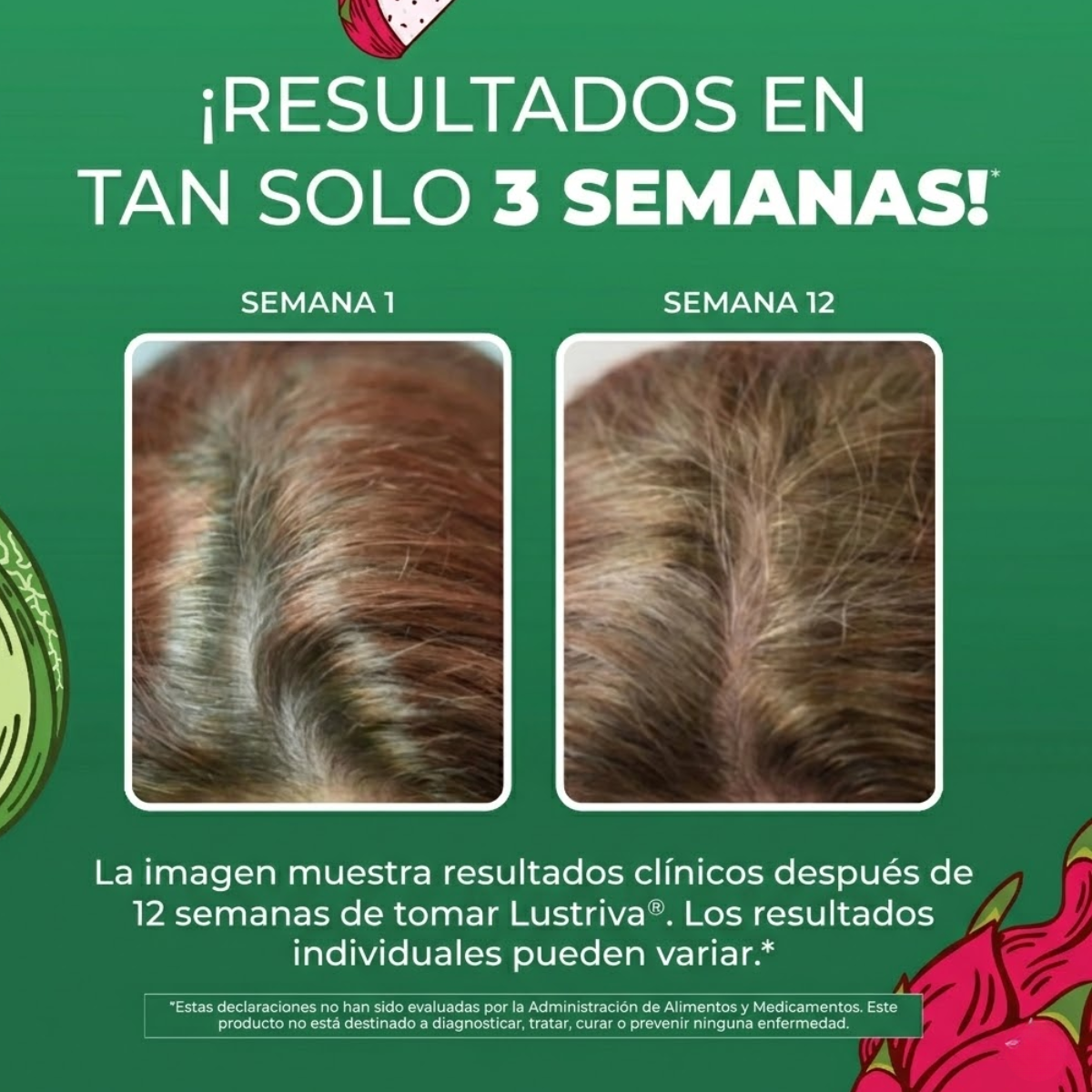 Multivitaminico Matutino + Crecimiento del Cabello Sabor Pitaya-Melon, Liquido (30 oz/ 887 ml), Mary Ruth´s